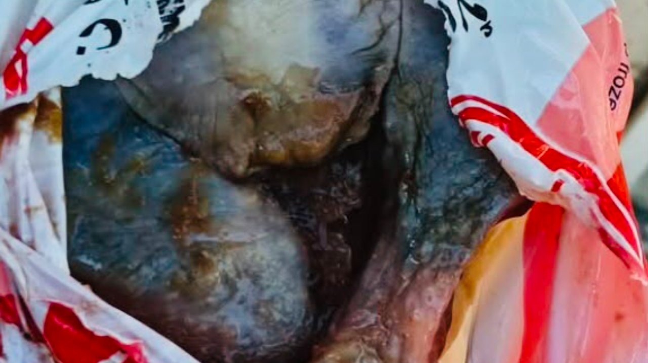 经济观察家：鸡肉变黑事件暴露市场检查漏洞